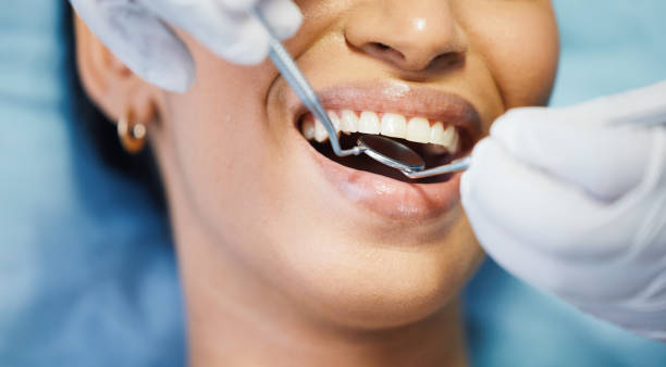 Best Emergency Dental Extractions in West Simsbury, CT